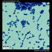 enterococcus faecalis microscopy